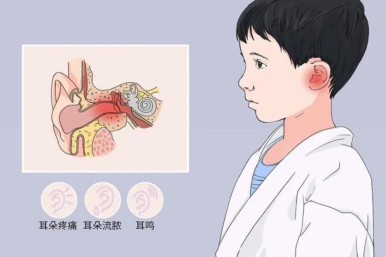 【科普】关于中耳炎那些事儿你了解多少 - 健康资讯 - 信阳市人民医院